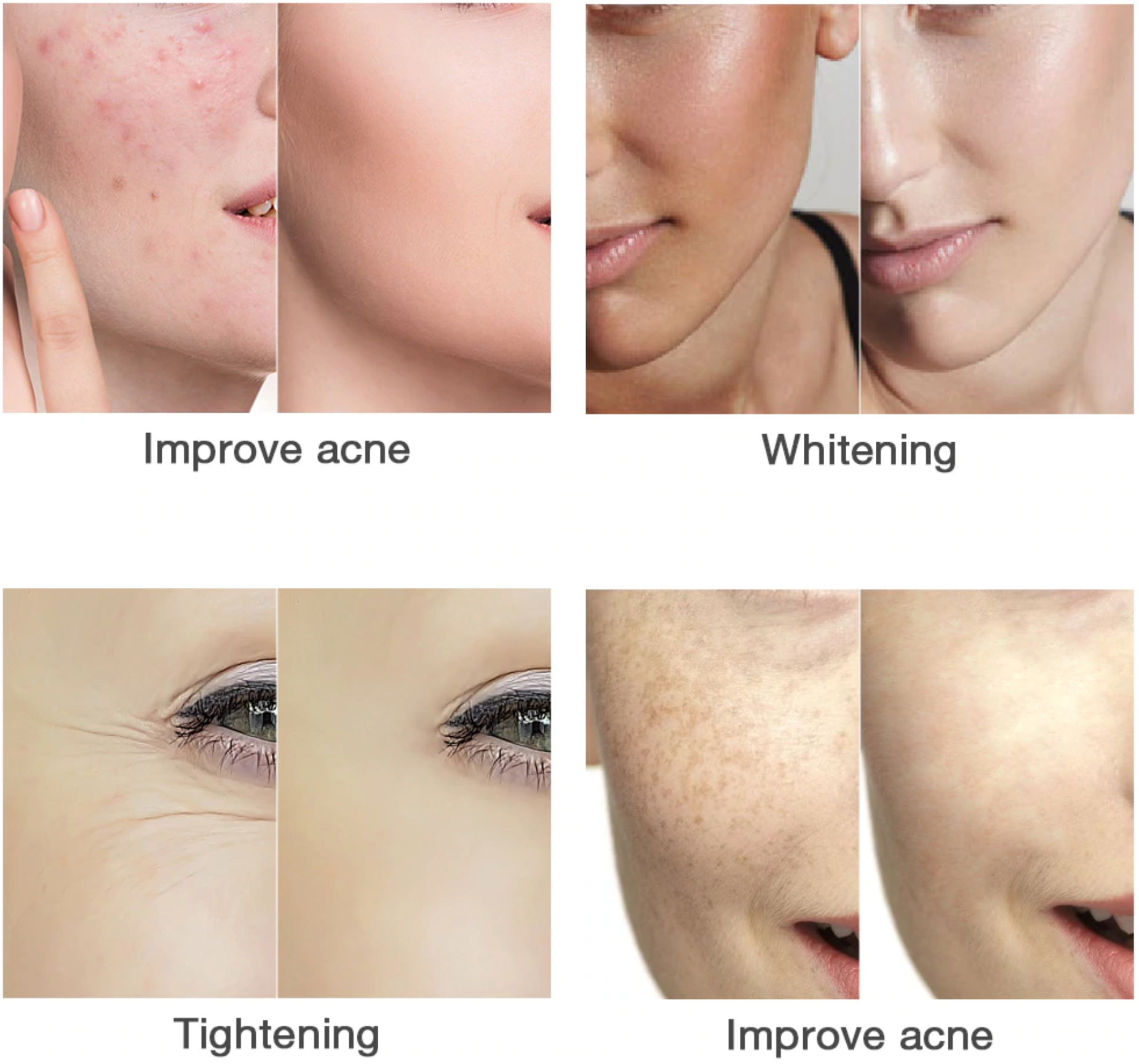 Anti-aging Light Therapy Beauty Face Screen